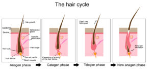 Landmark Hair Loss Clinic